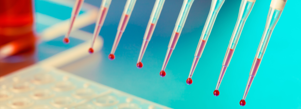 VarSeq for Testing Labs
